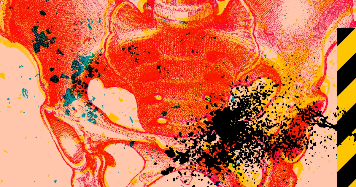 Endometriose: Ny forståelse av systemsykdommen krever behandlingsendring