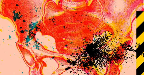 Endometriose: Ny forståelse av systemsykdommen krever behandlingsendring