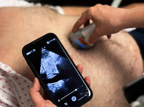 Sykepleiere kan avdekke hjertesvikt-forverring med lungeultralyd